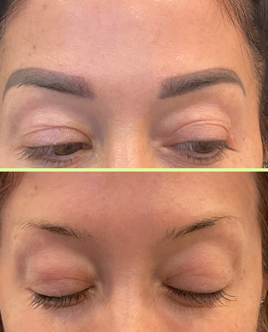 Eyebrow Removal (Per Session)