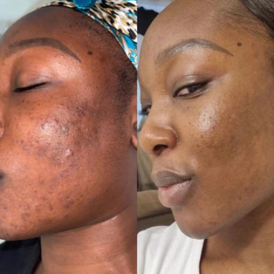 Bespoke herbal facials