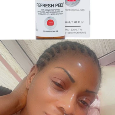 Rejuvenate & Refresh peel