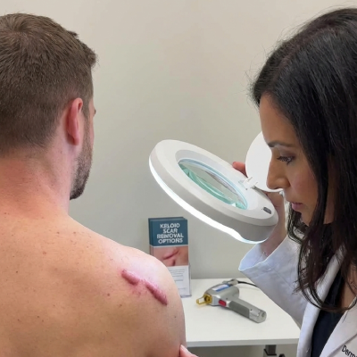 Kheloid Scar Removal