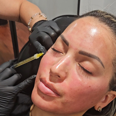 Exosomes under the eyes