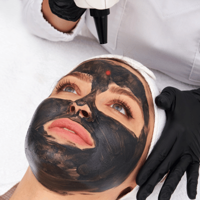 Carbon Peel Facial