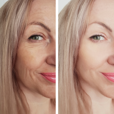 Dissolve & Refill Package