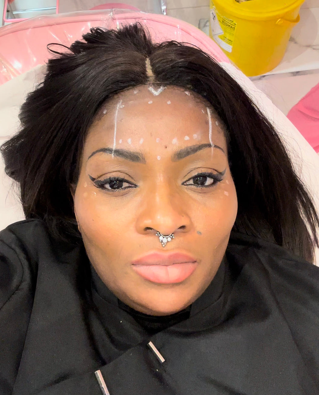 Anti-Wrinkle Injections
