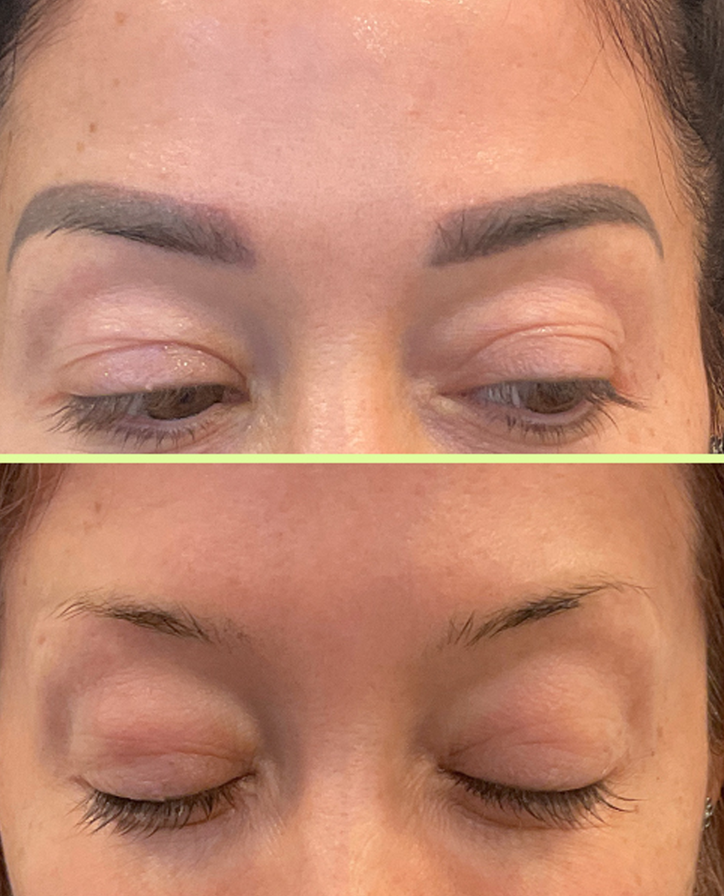 Ink Eyebrow Removal