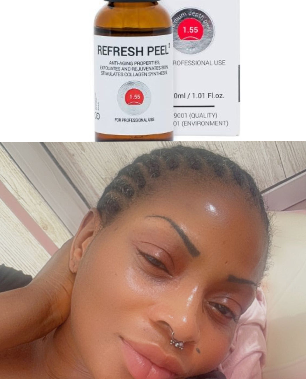 Rejuvenate & Refresh peel