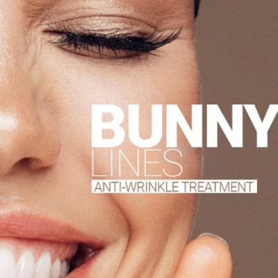 Bunny Lines